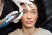 Brow Lift Services in Melbourne
