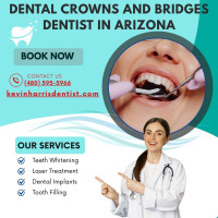 Dental Crowns and Bridges | Dentist in Arizona Kevin Harris Dentist.