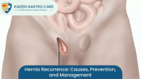 Top Hernia Doctor in Pune – Expert Hernia Surgery & Treatment