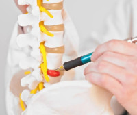 Herniated Disc Lower Back | Mainstay Medical