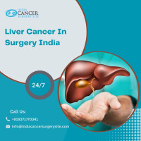 Liver Cancer Best Treatment in India