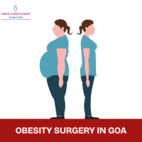 Bariatric Surgery Cost in Goa