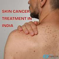 Top Skin Cancer Hospitals in India