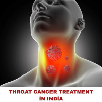 Best Throat Cancer Surgeons in India