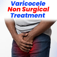 Bharat Homeopathy’s Varicocele Care: Comprehensive Non-Surgical Treatments