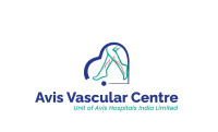 Best Hospital in Coimbatore for Varicose Vein Treatment | Advanced Laser & Expert Care