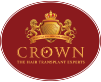 Regain Confidence with Crown Hair Transplant Experts: Your Trusted Hair Restoration Clinic