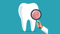 Simple Tooth Extractions in Arizona, United States – Kevin Harris Dentist
