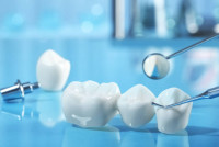 Dental crown in Islamabad